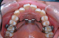 or02