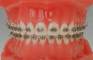 or04